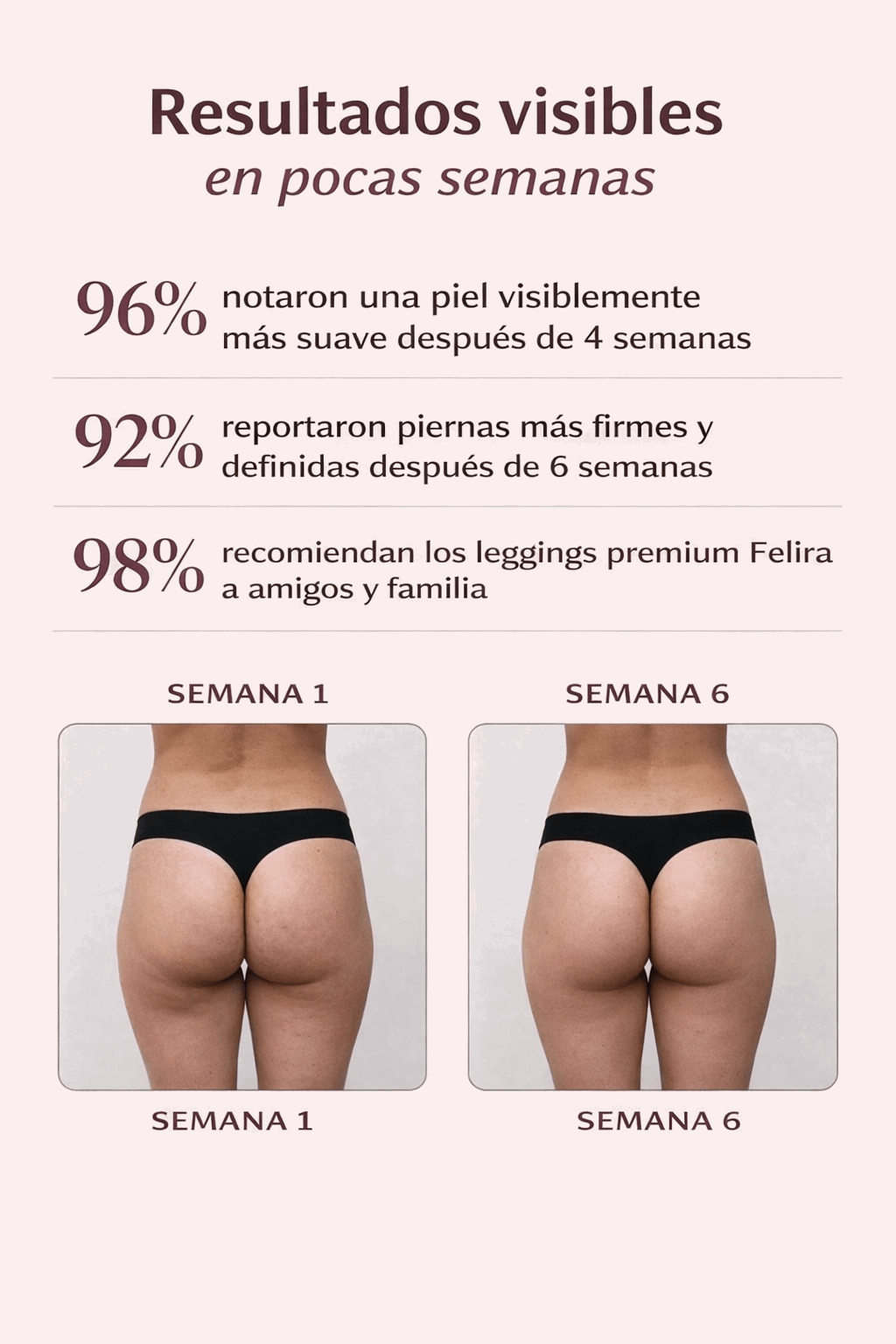 Cellumove Felira FigurPro Shorts